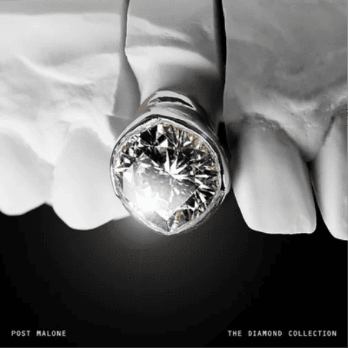 POST MALONE - The Diamond Collection Vinyl - JWrayRecords